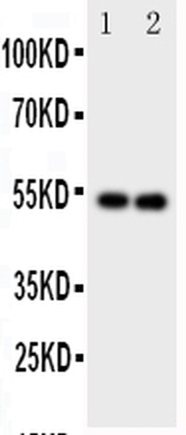 GABRA1 Antibody in Western Blot (WB)