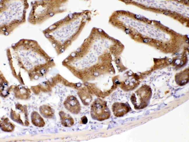 GALE Antibody in Immunohistochemistry (Paraffin) (IHC (P))