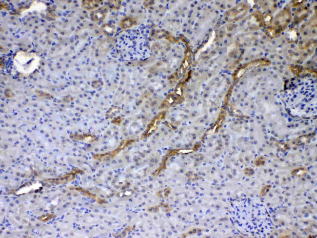 GALE Antibody in Immunohistochemistry (Paraffin) (IHC (P))