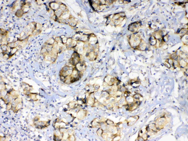 GALE Antibody in Immunohistochemistry (Paraffin) (IHC (P))