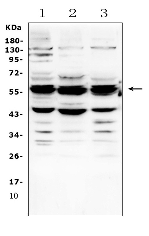 GALNS Antibody in Western Blot (WB)