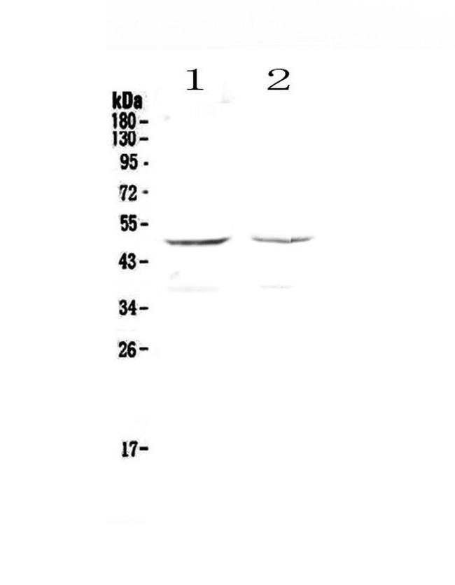 GALT Antibody in Western Blot (WB)