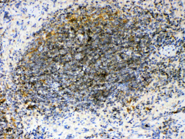 GAS6 Antibody in Immunohistochemistry (Paraffin) (IHC (P))