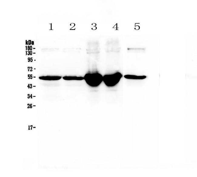 GC Antibody in Western Blot (WB)