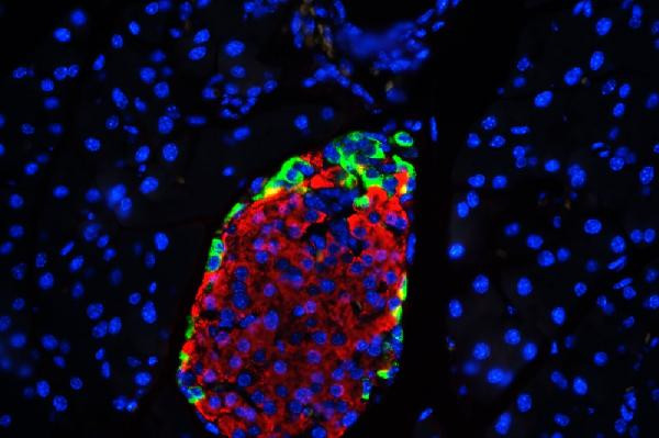 GLP-1 Antibody in Immunohistochemistry (Paraffin) (IHC (P))