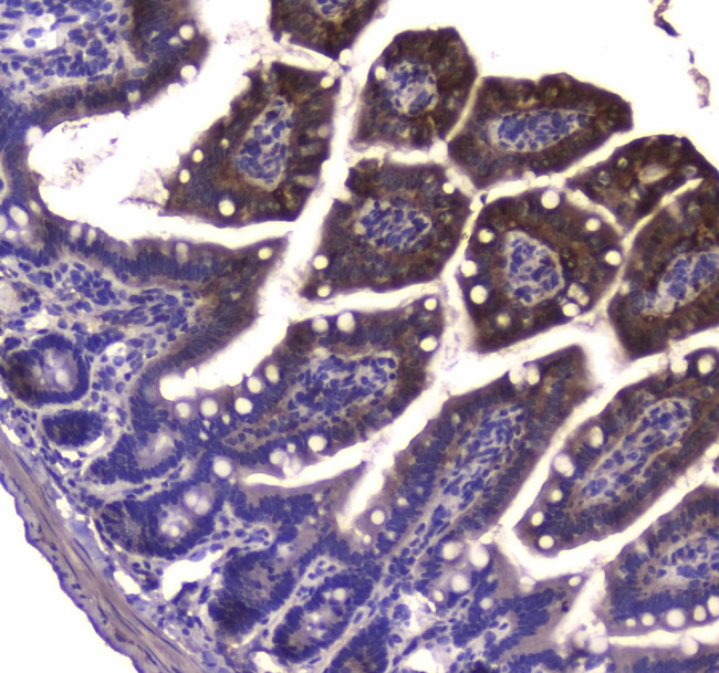 GDA Antibody in Immunohistochemistry (Paraffin) (IHC (P))