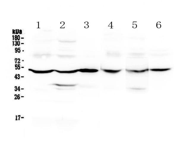 GDA Antibody in Western Blot (WB)