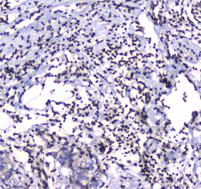 GFI1 Antibody in Immunohistochemistry (Paraffin) (IHC (P))