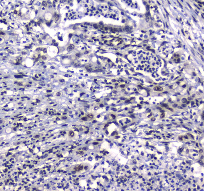 GFI1 Antibody in Immunohistochemistry (Paraffin) (IHC (P))