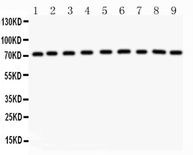 Growth Hormone Receptor Antibody in Western Blot (WB)