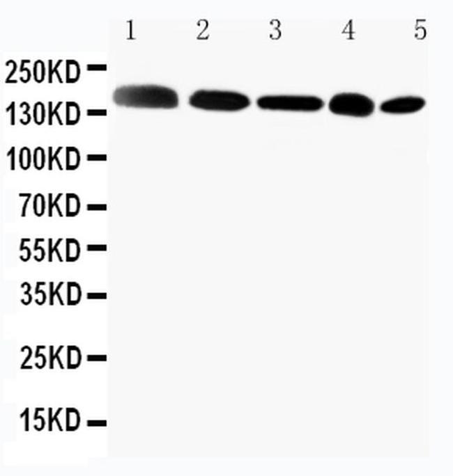 GLI2 Antibody in Western Blot (WB)