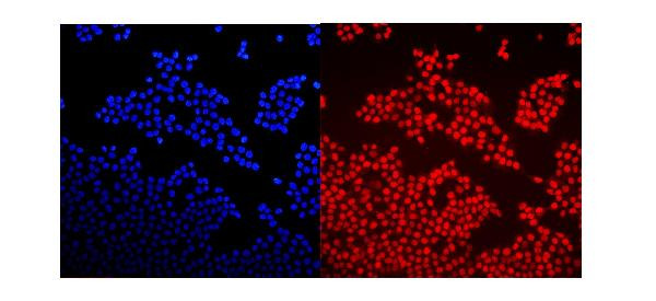 GNAQ Antibody in Immunocytochemistry (ICC/IF)