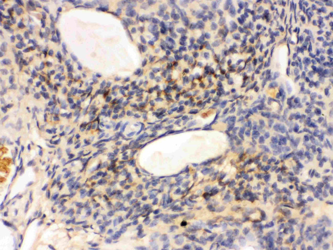 GNAQ Antibody in Immunohistochemistry (Paraffin) (IHC (P))