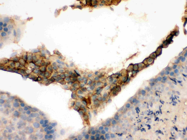 GNAQ Antibody in Immunohistochemistry (Paraffin) (IHC (P))