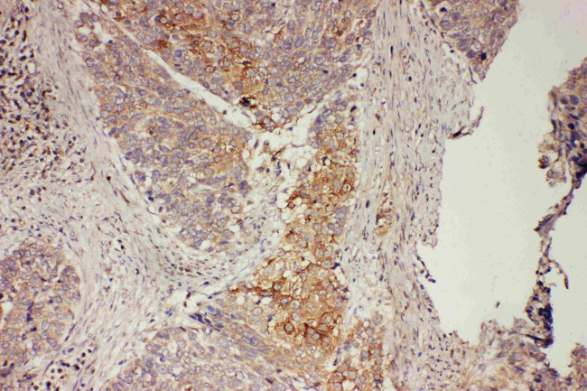 GRB7 Antibody in Immunohistochemistry (Paraffin) (IHC (P))