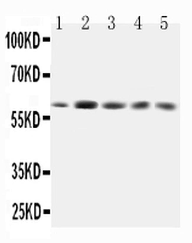 GRB7 Antibody in Western Blot (WB)