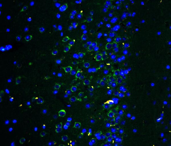 GluR2 Antibody in Immunohistochemistry (Paraffin) (IHC (P))