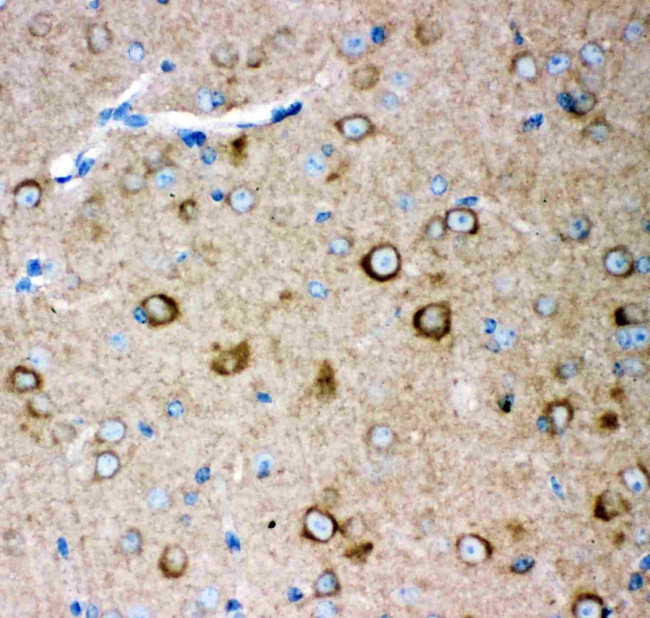 GluR2 Antibody in Immunohistochemistry (Paraffin) (IHC (P))