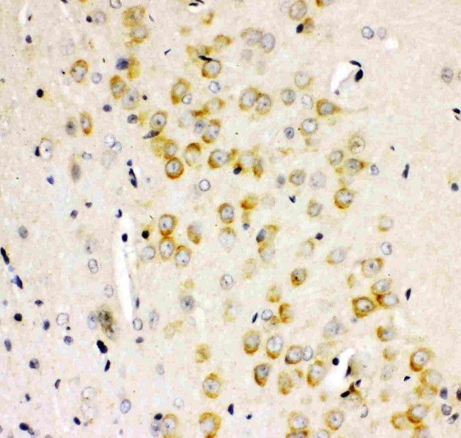 GluR2 Antibody in Immunohistochemistry (Paraffin) (IHC (P))