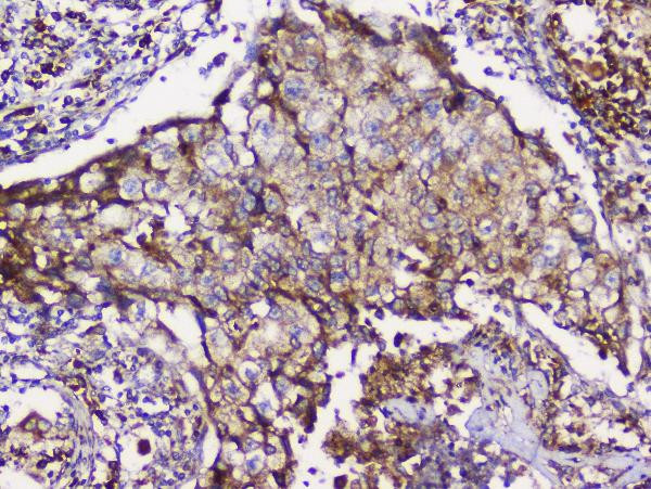 GRIK1 Antibody in Immunohistochemistry (Paraffin) (IHC (P))