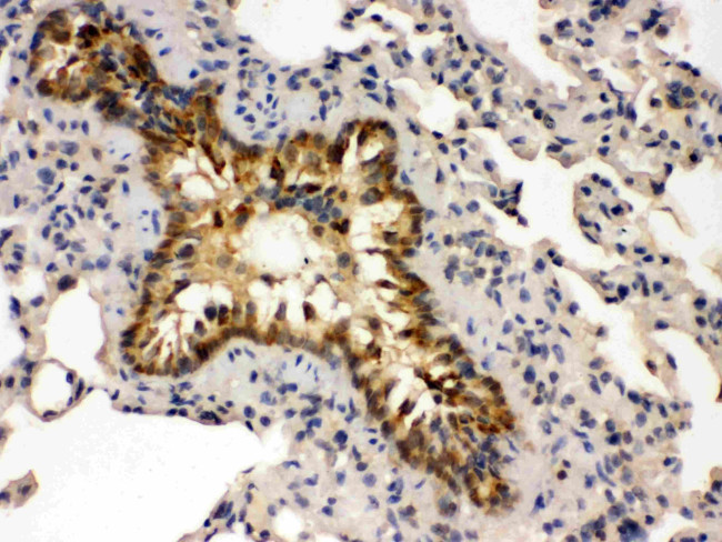 GRK5 Antibody in Immunohistochemistry (Paraffin) (IHC (P))