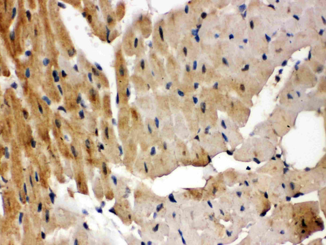 GRK5 Antibody in Immunohistochemistry (Paraffin) (IHC (P))