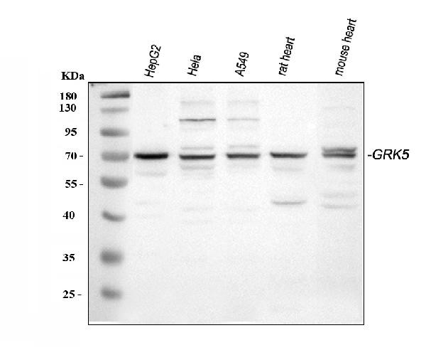 GRK5 Antibody in Western Blot (WB)