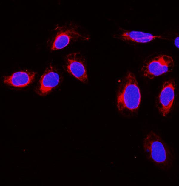 Gelsolin Antibody in Immunocytochemistry (ICC/IF)