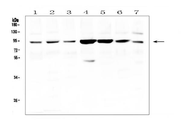 Gelsolin Antibody in Western Blot (WB)