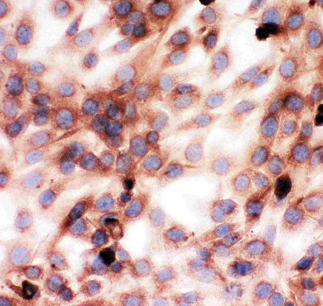 Gelsolin Antibody in Immunocytochemistry (ICC/IF)