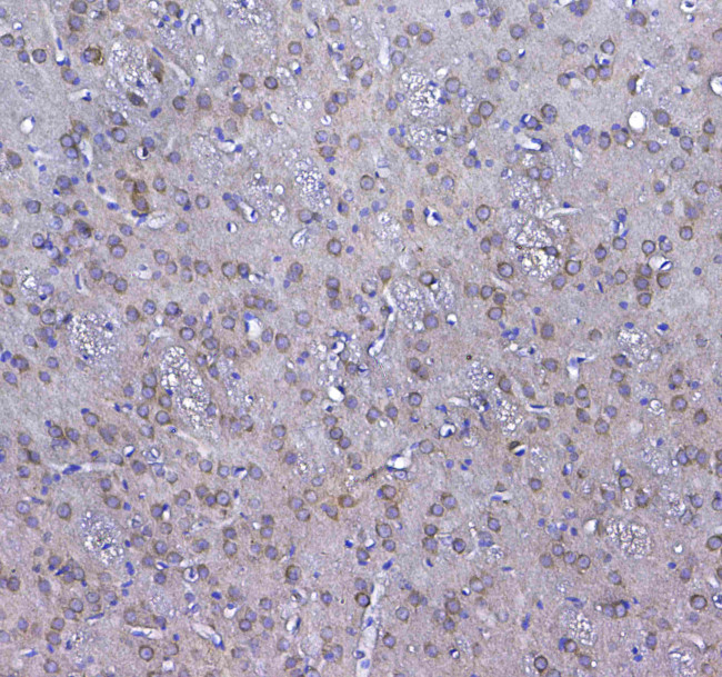 GSTM3 Antibody in Immunohistochemistry (Paraffin) (IHC (P))