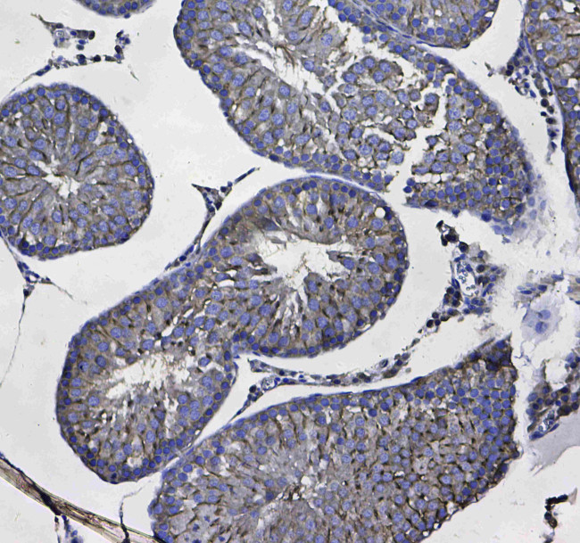 GSTM3 Antibody in Immunohistochemistry (Paraffin) (IHC (P))