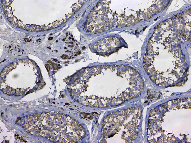 GSTM3 Antibody in Immunohistochemistry (Paraffin) (IHC (P))