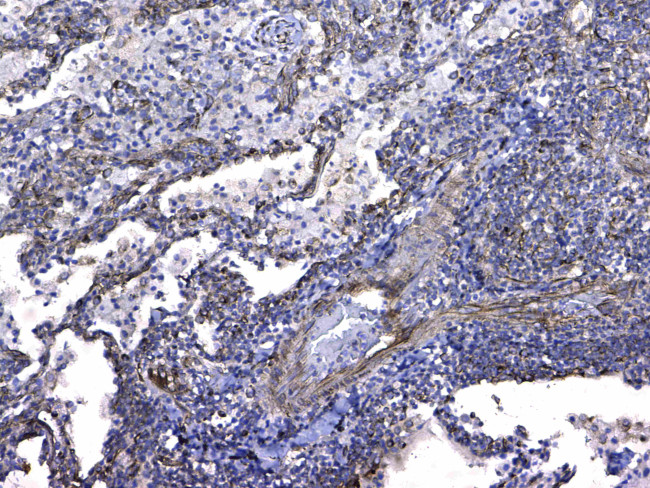 GSTM3 Antibody in Immunohistochemistry (Paraffin) (IHC (P))