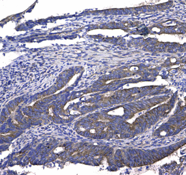 GSTM3 Antibody in Immunohistochemistry (Paraffin) (IHC (P))