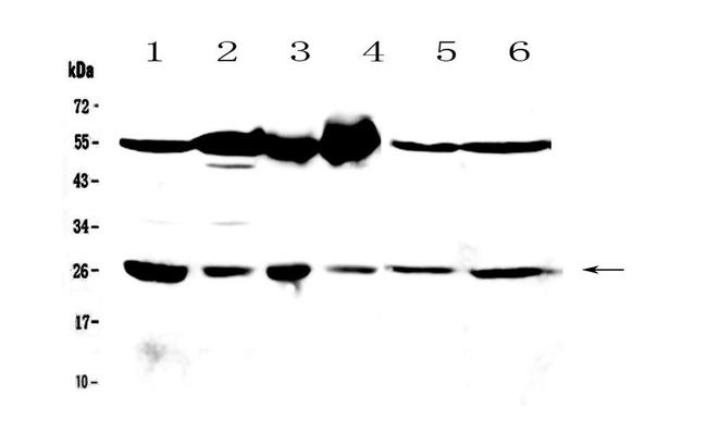 GSTM3 Antibody in Western Blot (WB)