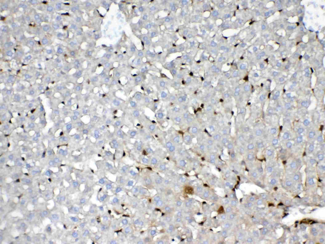 GSTP1 Antibody in Immunohistochemistry (Paraffin) (IHC (P))