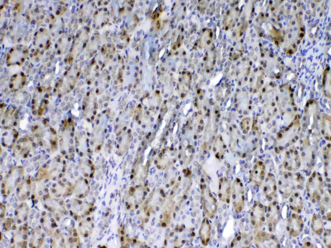 GSTP1 Antibody in Immunohistochemistry (Paraffin) (IHC (P))