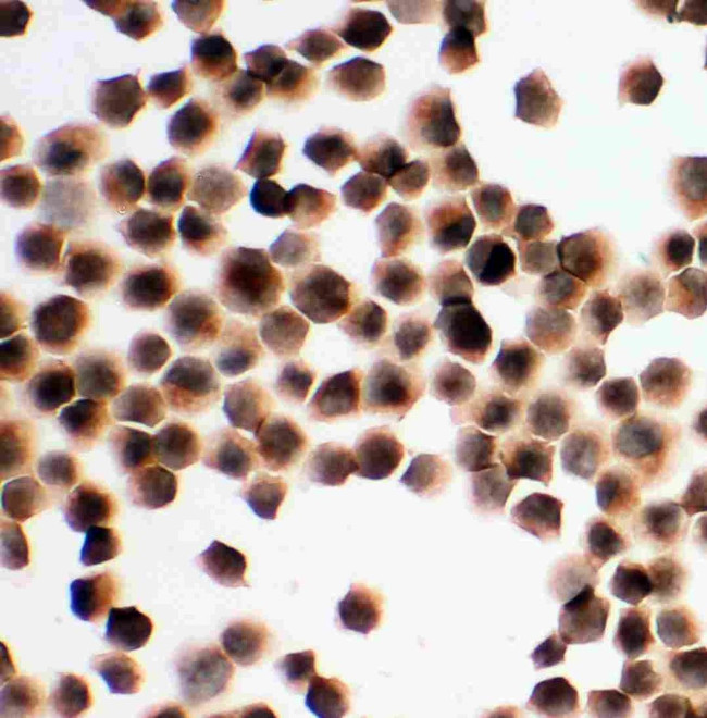 KIM-1 Antibody in Immunocytochemistry (ICC/IF)