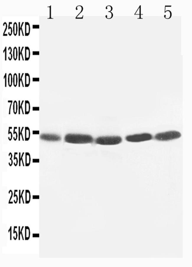 KIM-1 Antibody in Western Blot (WB)