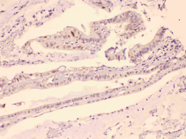 HDGF Antibody in Immunohistochemistry (Paraffin) (IHC (P))