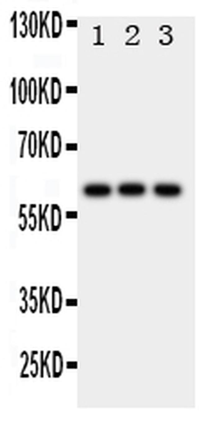 HEXA Antibody in Western Blot (WB)