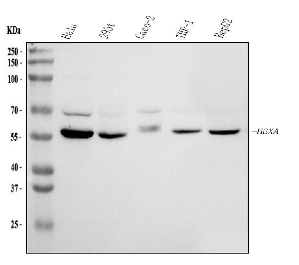 HEXA Antibody in Western Blot (WB)