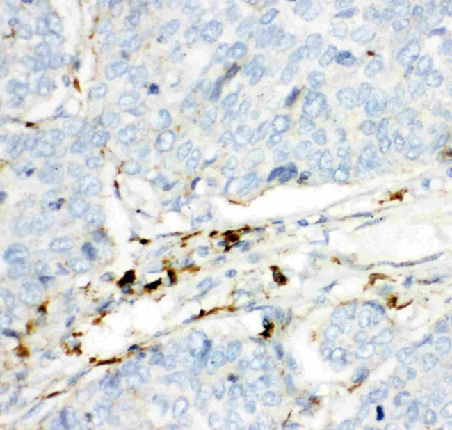 HEXB Antibody in Immunohistochemistry (Paraffin) (IHC (P))