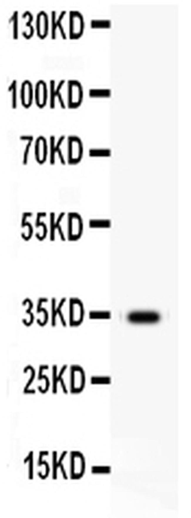 HGF Antibody in Western Blot (WB)