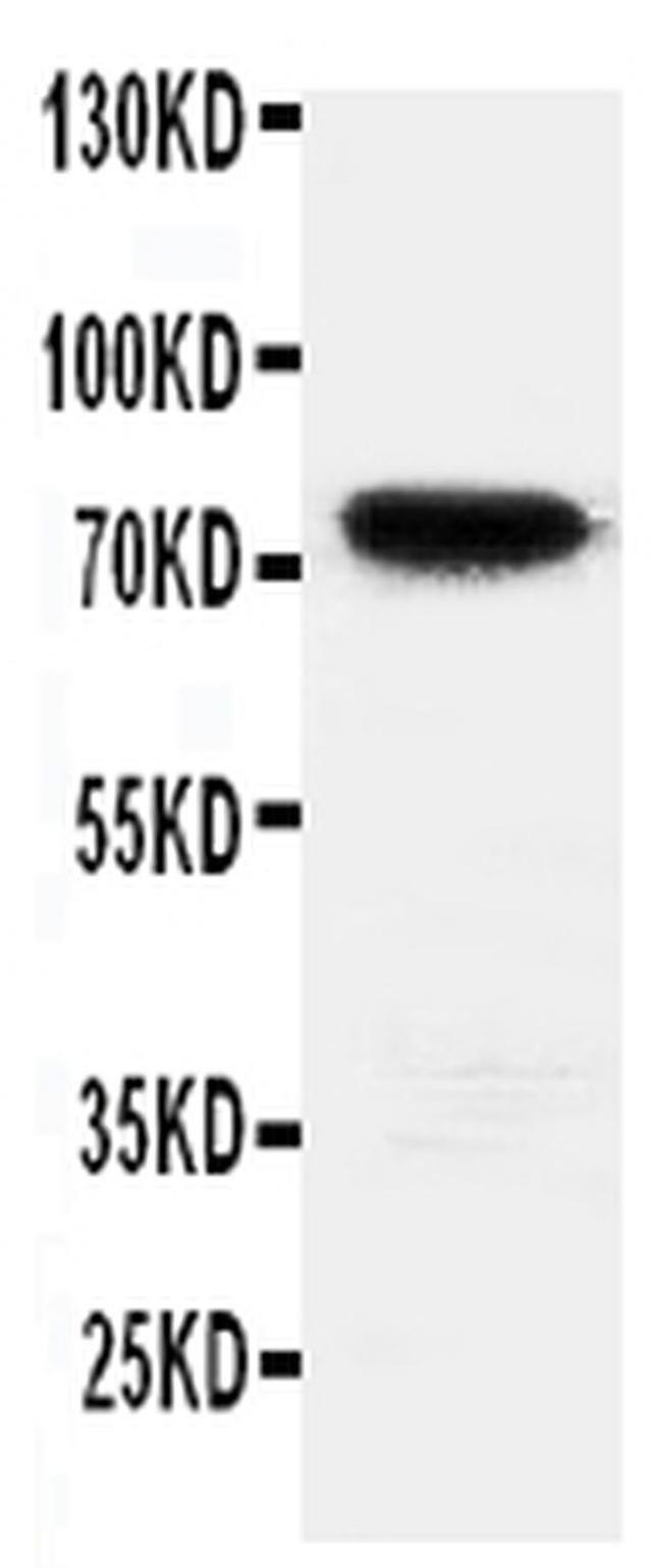 HIF3A Antibody in Western Blot (WB)