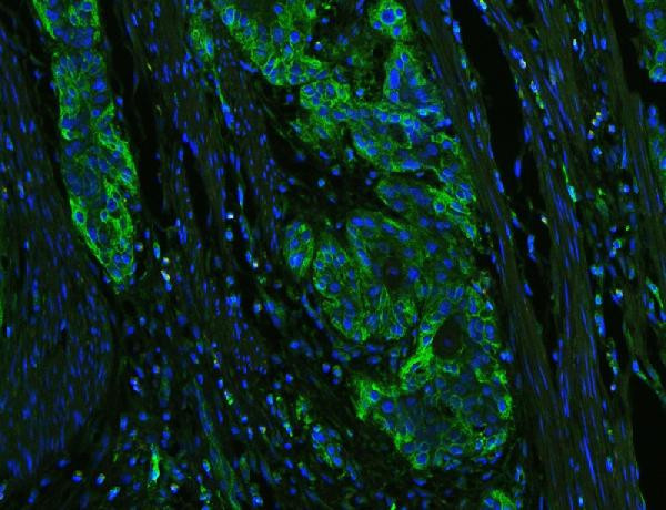 HLA-C Antibody in Immunohistochemistry (Paraffin) (IHC (P))