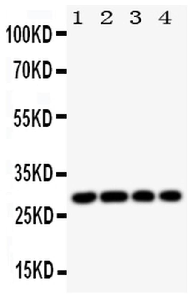 HLA-DMB Antibody in Western Blot (WB)