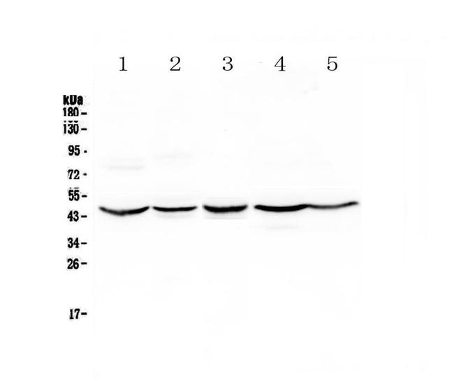 HMBS Antibody in Western Blot (WB)