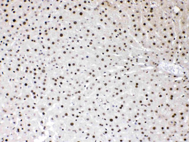 HMGB1 Antibody in Immunohistochemistry (Paraffin) (IHC (P))